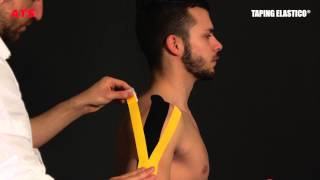 Taping Elastico®  Applicazione Stabilizzante Spalla [upl. by Ahsiemaj]