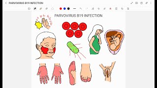 PARVOVIRUS B19 INFECTION [upl. by Glenn772]