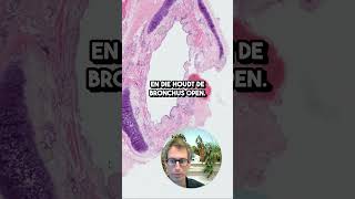 Bronchus Histologie van een Bronchus [upl. by Franklin201]