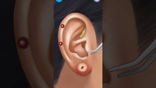 Ear wax ASMR asmr animation [upl. by Ligetti]