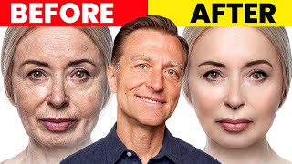 The Ultimate Face Transformation–Dr Bergs Best Remedy for Dry Skin and Wrinkles [upl. by Cooperman]