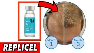 Replicel amp Shiseido Anti Hair Loss Treatment 2019 UPDATE [upl. by Drucy331]