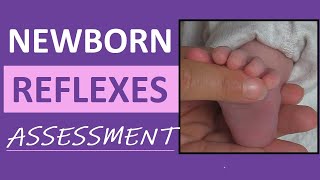 Newborn Reflexes Assessment Infant Nursing Pediatric NCLEX Review [upl. by Elma]