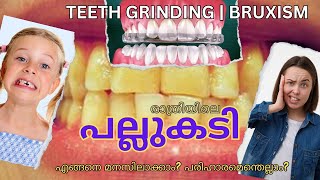 Solution for Night Time teeth Grinding  Clenching  Bruxism  ഉറക്കത്തിലെ രാത്രിയിലെ പല്ലുകടി [upl. by Romo]