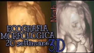 Video Ecografia MORFOLOGICA in 3D 20 settimane di gravidanza💙 Noah💙 [upl. by Ferris]