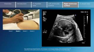 Key screening views of the fetal heart  Part 5  Right ventricular outflow [upl. by Selima]