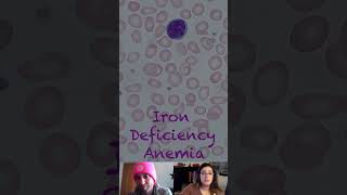 Irondeficiency Anemia Etiology and Pathology – Pediatric Nursing  Lecturio Nursing [upl. by Haynor]