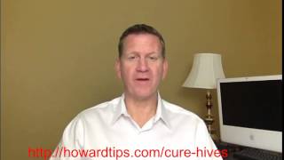 How To Cure Hives At Home  Home Remedies For Hives [upl. by Chuck]