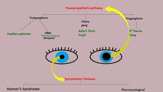 Anisocoria  evaluation of anisocoria  examination part 1 Approach to Anisocoria algorithm [upl. by Nnylahs244]