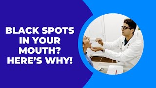 Mysterious Black Spots Inside Your Cheek What They REALLY Mean [upl. by Hairaza]