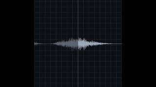 Fine Crackles Recording amp Waveform  Eko Health [upl. by Elfreda]