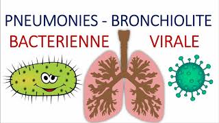 Comment différencier entre une pneumonie aigue communautaire bactérienne et virale atypique [upl. by Erolyat]