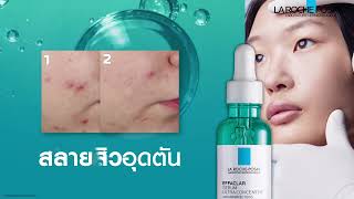 Effaclar Serum สลายได้ใน 2 สัปดาห์ [upl. by Nobell]