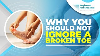 Why You Should Not Ignore a Broken Toe [upl. by Dania384]