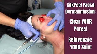 Skin Rejuvenation Treatment  DermalInfusion SilkPeel Facial [upl. by Ycniuqal]