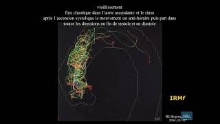 15  Physiologie cardio vasculaire partie 15 [upl. by Hgielra]