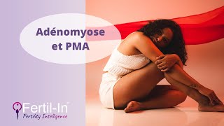 Adénomyose PMA  comment optimiser son protocole [upl. by Delogu]