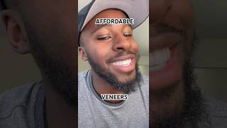 TERRIBLE Brighter Image Labs Veneers Review veneers invisalign snaponsmile smilemakeover [upl. by Githens673]