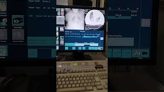 HRCT OF CHEST SCAN  radiology ct scan mri hospital education viralvideo hit toptrending [upl. by Wolgast]