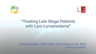 Treating Late Stage Patients with Lipo Lymphedema 3 [upl. by Ecnarolf536]