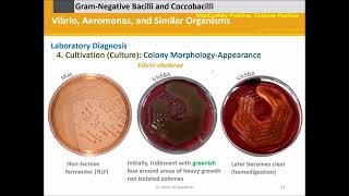 Vibrio Aeromonas and Similar Organisms [upl. by Alis]