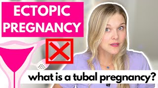 Ectopic and Tubal Pregnancy [upl. by Eihtak207]