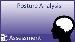 Posture Analysis updated version in description [upl. by Vladamir]