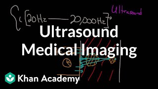 Mechanical Index Ultrasound Physics [upl. by Beatrice369]