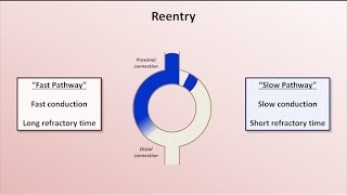 Intro to EKG Interpretation  Mechanisms of Tachyarrhythmias [upl. by Cassilda914]