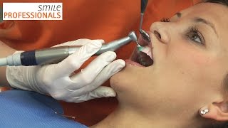 Professionelle Zahnreinigung  Zahnarzt Dr Seifert Aschaffenburg  Smile Professionals [upl. by Attevroc]