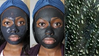 Easy DIY Blackhead Remover Peel Off Mask REMOVES EVERYTHING [upl. by Noryv]