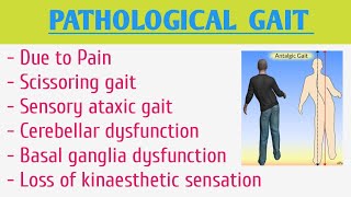 Pathological Gait [upl. by Nylimaj545]