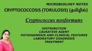 Cryptococcosis Torulosis  Cryptococcus neoformans  pathogenesis lab diagnosis treatment Tamil [upl. by Pelson]