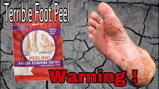 Warning ⚠️ Don’t buy  Foot Peel Gone Wrong [upl. by Hoffman]