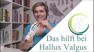 Das hilft bei Hallux Valgus podologinandrea [upl. by Salomo316]