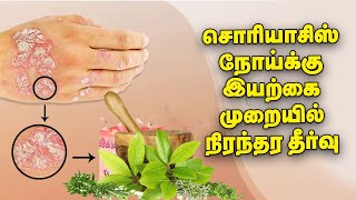 Psoriasis நோய்க்கு Steroid இல்லாத இயற்கை முறையில் நிரந்தர தீர்வு  Nalam 360  Drஅமுதா தாமோதரன் [upl. by Ynez]