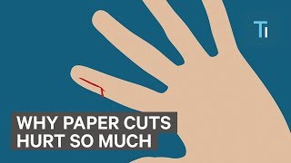 Why Paper Cuts Hurts So Much [upl. by Doty]