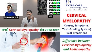 Cervical Myelopathy Physiotherapy Treatment  Causes Symptoms Test amp Grading  NO SURGERY NEEDED [upl. by Noislla575]