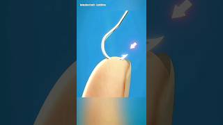 How To Remove A Fishhook 👀🤔🔥 [upl. by Yrocal344]