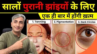 Pigmentation amp Dark Spots का 100 इलाज Treatment Naturally I DR MANOJ DAS drmanojdas [upl. by Nor]