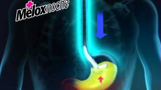 Melox Noche [upl. by Onfroi]