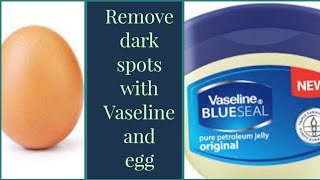 How to use Vaseline and egg to treat Hyperpigmentation vaseline [upl. by Christiana]