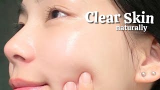 how I cleared My skin In 30 days naturally [upl. by Llertram]