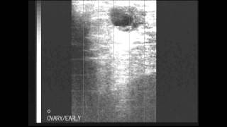 BCF Technology Ultrasonography of the bovine reproductive tract video 8  Ultrasound clip [upl. by Noelani]