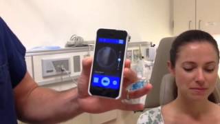 How to use an iPhone Otoscope [upl. by Beyer]