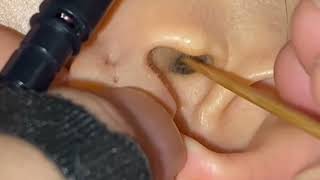 Ear ASMR Tingles  Ear Cleaning ASMR No Talking  Video for Stress Relief [upl. by Dallis]