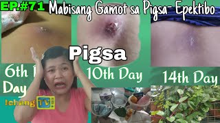 PIGSA Mabisang Gamot sa Pigsa Pigsang Dapa o Walang Mata  Proven Effective [upl. by Philips]