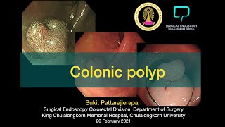 Colonic polyp lecture Thai language on Young Colo Surgeon Forum 2022021 [upl. by Launcelot]