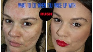 what to do if you have rash on your face  contact dermatitis [upl. by Kirwin]