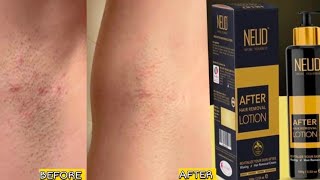 Neud after hair removal lotion review how to use hair removal lotion [upl. by Amles545]